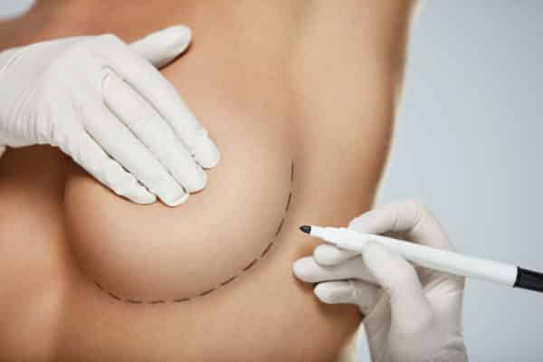 Chirurgie poitrine