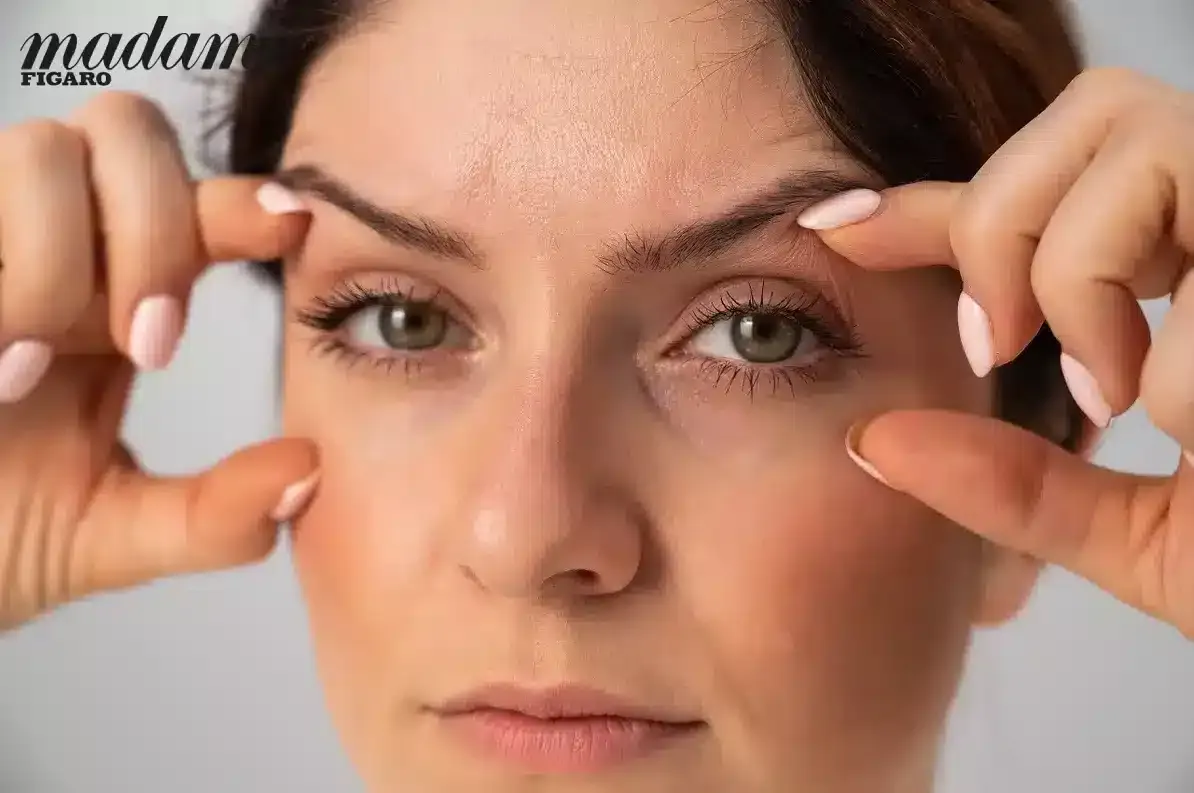 Figaro Blépharoplastie