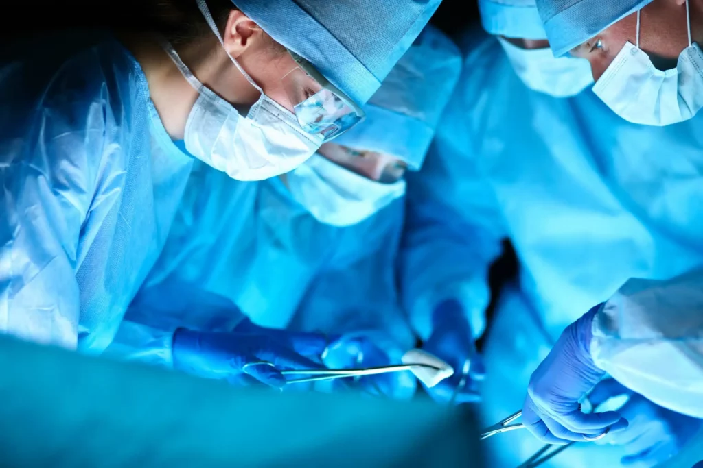 Le lifting de bras ou brachioplastie