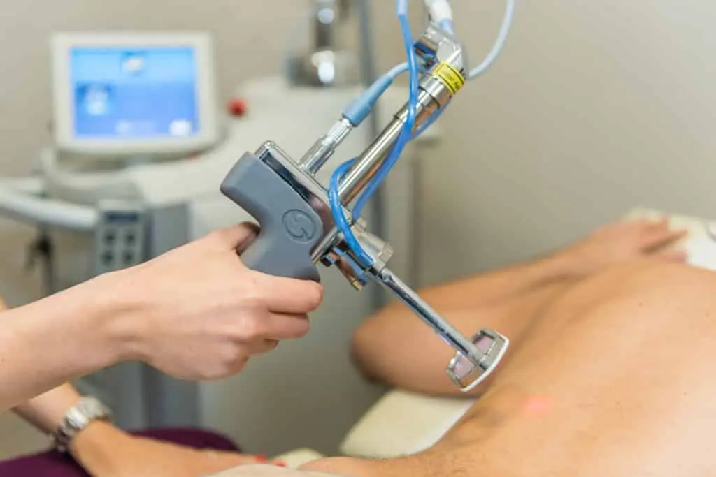 laser hair removal 1